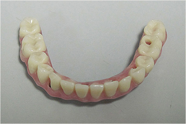 The image shows a single tooth with a pink gumline, placed against a white background.