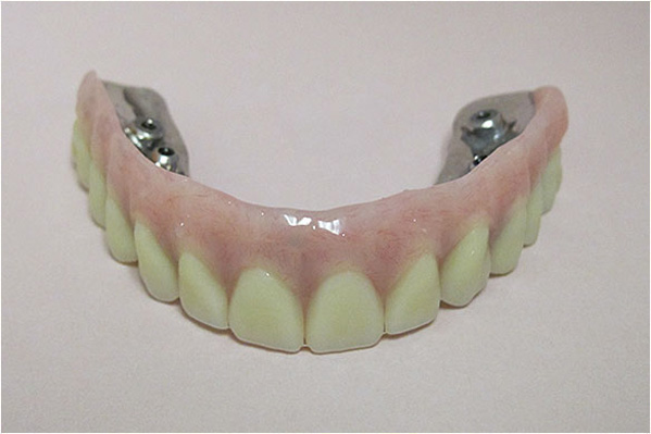 The image shows a set of yellow, human-like teeth with visible enamel wear and gaps between them, placed against a plain background.