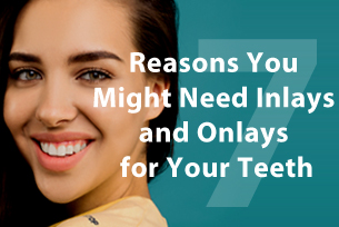 7 Reasons You Might Need Inlays and Onlays for Your Teeth